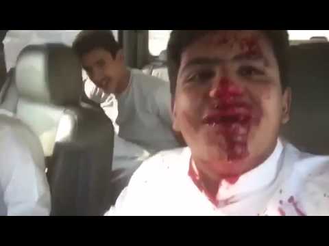 بالفيديو .. شاب يوثق إصابته إثر حادث .. هل هذه الدماء حقيقية ؟!
