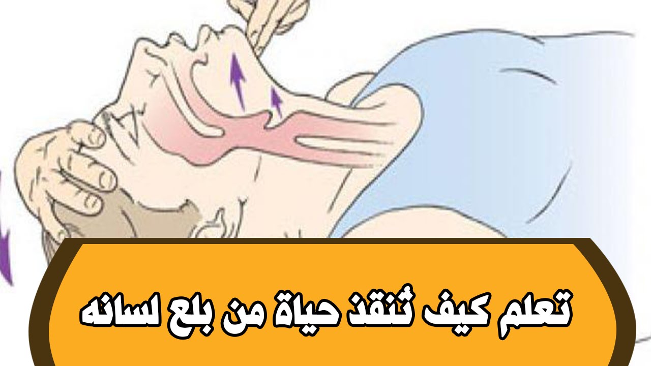 بالفيديو … كيف تنقذ حياة إنسان من الموت بسبب بلع لسانه