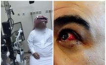 طالب ثانوي يطعن وكيل مدرسة في عينه اليسرى ويحدث فيها إصابة قوية .. و”التعليم” يحقق