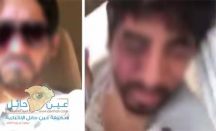 تعرضه للضرب من شيلة تخص إحدى القبائل