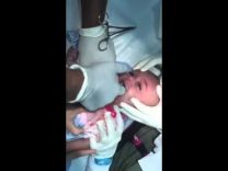 بالفيديو: أطباء يخرجون ساعة من حلق طفل
