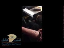 بالصورة: التقرير الطبي يكشف كذب خادمة اتهمت كفيلها بتعذيبها وحرقها بالنار!