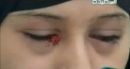 تتعرق دماً وتبكي حجراً #بالفيديو… فتاة يمنية