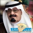 خريجو وخريجات الدبلومات الصحيه يناشدون وزير الصحة د. توفيق الربيعة