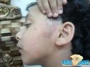 طالب (يتيم) ويوقع فيه أصابه  تجبره على الشفاء لمدة 4 أيام#معلم بثانوية الأجفر يعتدي على