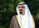 جراحية بالحرس الوطني الاسبوع المقبل# خادم الحرمين يجري عملية