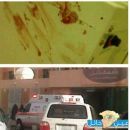 مشاجره بين طالبتين نتج عنه طعن وإغماء لأحدهن السبت وجامعة حائل تنفي  #بجامعة حائل للبنات  ( السنة التحضيرية )