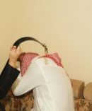 زوج يتهم زوجته بضربه وعضه وجلده بـ«العقال»