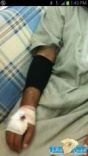 يعض احد المواطنين بمحافظة بقعاء ويتسبب باصابات متفرقه#بالصور _ كلب مسعور