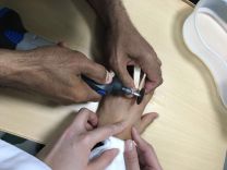 مدني الغزالة نقذ طفل من خاتم علق بإصبعه