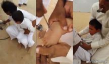 يكوون طفلاً بالنار ما بين ( علاج الخشة _ وارهاب الطفل )