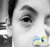 معلم يضرب طالب بقلم على عينه ووالد الطالب يتنازل فورا تقديرا للمعلم ومهنة التعليم