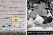 صحة حائل توضح ملابسات وضع جبيرة على قدم يمنى لمصاب بدلاً من اليسرى