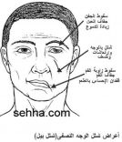 التحذير من مرض “الوجه” في ظل موجة البرد
