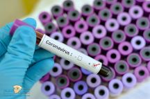 شركة فرنسية تعلن عن أول علاج لفيروس “كورونا”