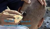 أين يذهب شعر 2.3 مليون حاج كل عام؟